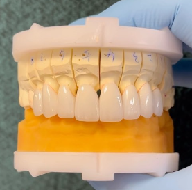 Cosmetics, veneers & whitening