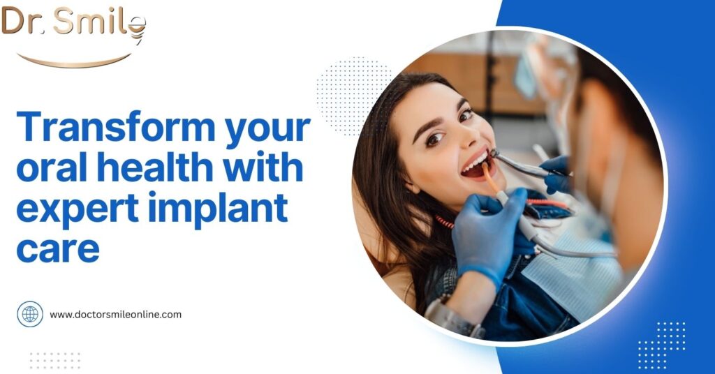 How Dental Implants in San Pedro Can Restore Your Smile & Oral Health?