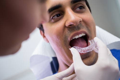 Pain-Free Full Mouth Restoration in Lomita