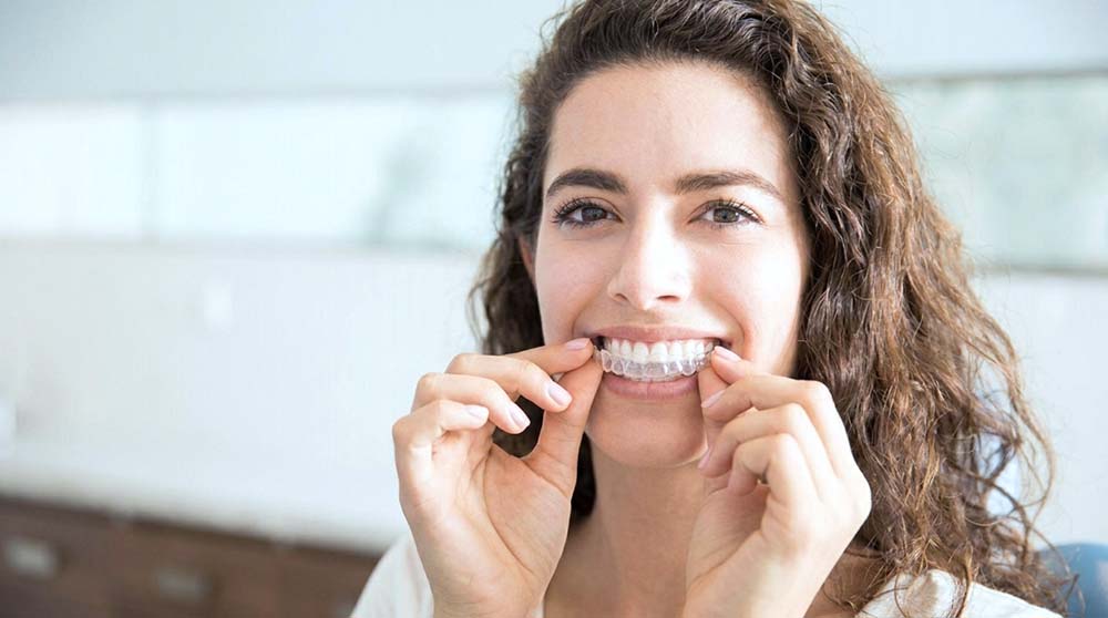 Dental Invisalign Treatment